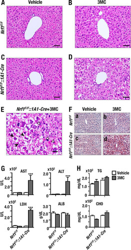 FIG 2 Nrf1 deficiency results in hepatic steatosis and acute liver injury consistent with NASH. (A to D) Formalin-fixed liver sections from Nrf1F/F and Nrf1F/F::1A1-Cre mice. The mice had been injected s.c. with a single dose of corn oil (vehicle) or 3MC 14 days prior to sacrifice. Livers from these animals were stained with hematoxylin and eosin (H/E). The images were collected under a magnification of ×200. (A) Vehicle-administered Nrf1F/F mice; (B) 3MC-administered Nrf1F/F mice; (C) vehicle-administered Nrf1F/F::1A1-Cre mice; (D) 3MC-administered Nrf1F/F::1A1-Cre mice. Scale bars represent 50 μm. (E) Higher magnification of the section presented in panel D. Open arrowheads show apoptotic hepatocytes, while filled arrowheads show Mallory bodies at a magnification of ×400. The scale bar represents 20 μm. (F) Liver frozen sections stained with oil red O. a, vehicle-administered Nrf1F/F mice; b, 3MC-administered Nrf1F/F mice; c, vehicle-administered Nrf1F/F::1A1-Cre mice; d, 3MC-administered Nrf1F/F::1A1-Cre mice. (G) Alanine aminotransferase (ALT), aspartate aminotransferase (AST), and lactate dehydrogenase (LDH) enzyme activities and albumin (ALB) protein level in plasma. (H) Triacylglyceride (TG) and cholesterol (CHO) levels in plasma. Plasma samples of four mice per group were measured using standard clinical chemistry assays. Error bars represent SEM. The statistical significance of results compared with data from the entire control group was calculated using a one-way ANOVA with the Newman-Keuls multiple-comparison test. ***, P < 0.001.