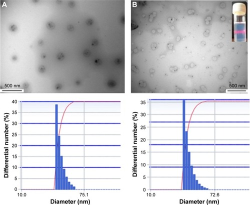 Figure 3 The TEM images and the particle size distribution of ME (A) and GMME (B).Abbreviations: TEM, transmission electron microscopy; ME, microemulsion; GMME, glimepiride microemulsion.