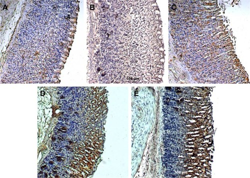 Figure 6 Rat gastric tissue showing HSP70 expression.