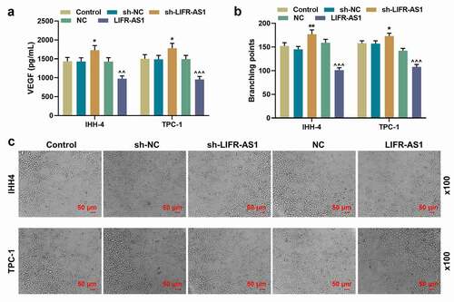 Figure 3. LIFR-AS1 regulated the content of VEGF in supernatant of PTC cells and angiogenesis of HUVECs