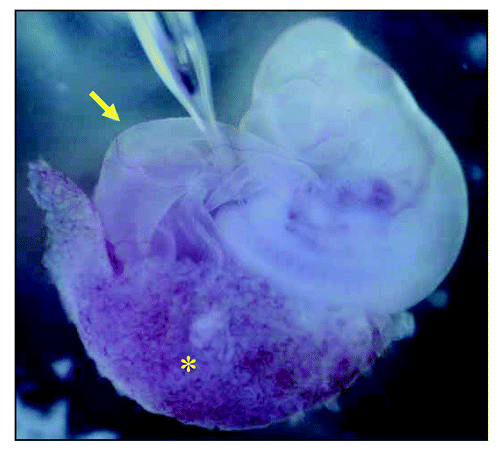 Figure 1 Injection of human mesenchymal stem cells (hMSCs) into growing rat embryo at the sit of nephrogenesis. Using mouth pipette, hMSCs were injected into the intermediate mesoderm between the somite and the lateral plate at the level of somite 29, which we previously estimated by in situ hybridization for c-ret, to be the ureteric budding site. Asterisk indicates chorioallantoic placenta and arrow indicates yolk sac.