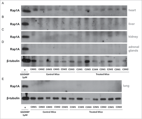 Figure 5. Rap1A geranylgeranylation is not altered in non-tumor burdened heart, liver, kidney, adrenal glands, and lung tissues of GGOHBP treated mice Representative Western blot analysis of Rap1A in non-tumorous (a) heart, (b) liver, (c) kidney, (d) adrenal glands and (e) lung tissues from control and treated mice. Control mouse C4M5 had too high of a lung tumor burden to collect non-tumorous lung tissue and so was not included. The anti-Rap1A antibody detects the unprenylated form of Rap1A as shown by the positive control GGOHBP treatment in luciferase-expressing PC-3 cells.