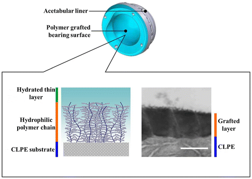 Figure 5. Schema of a THA with the PMPC-grafted CLPE liner. A transmission electron microscopy image of the surface is shown on the right. Orange and blue lines indicate the PMPC layer and the liner surface, respectively.[Citation68]