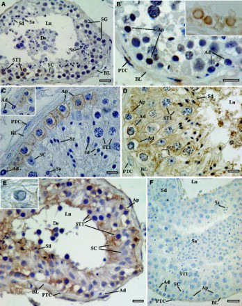 Figure 4.  Immunohistochemical localization of cell markers in paraffin sections of adult human testis. A, B inset-section without hematoxylin counterstaining) OCT4; C, inset) KIT; D) ITGA6; E, inset) ITGB1; and F) example of a negative control with primary antibody omission. BL: basal lamina; PTC: peritubular cells; SC: Sertoli cells; SG: spermatogonia; Ad: spermatogonia A-dark; Ap: spermatogonia A-pale; ST1: primary spermatocytes; Sa: round spermatids; Sd: elongated spermatids; Sz: spermatozoa; De: scaled cells in the lumen of the seminiferous tubule; Lu: lumen of the seminiferous tubule. Scale bars = 5 µm (B, C, E), 10 µm (D, F), and 20 µm (A).