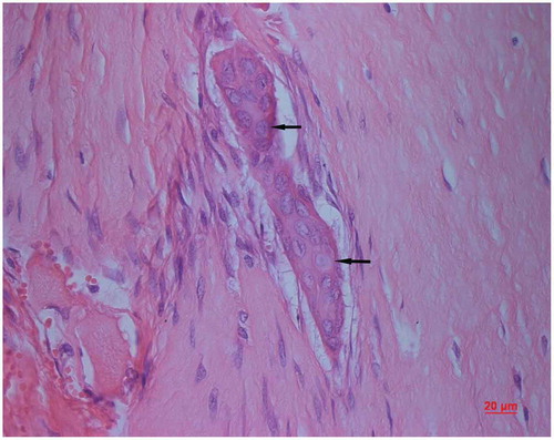 Figure 6. Internal growth of chondrocytes. The chondrocytes appear in groups and undergo cell division within their individual lacuna (arrow, HE) .