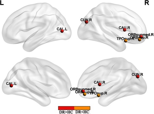 Figure 2 Significant nodal characteristics map the differences between two groups.