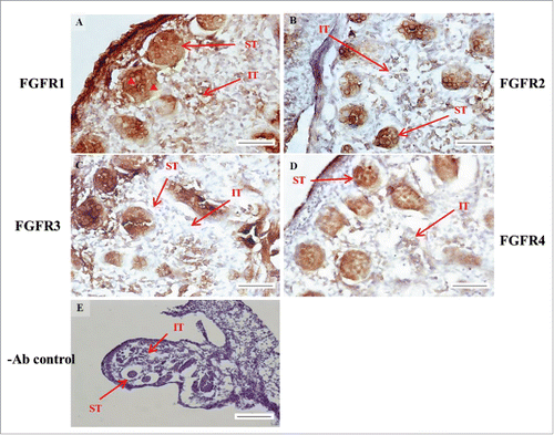 FIGURE 4. The expression patterns of FGFR1–4 at 15 d post coitum (dpc) in embryonic mice testis. The expression patterns of FGFR1 (A), FGFR2 (B), FGFR3 (C), and FGFR4 (D) at 15 dpc in mice testis were detected using immunohistochemistry. (E) represents control section without a primary antibody. The long arrow indicates the cell types as illustrated by the abbreviations: ST, seminiferous tubules and IT, interstitial region. The red arrowhead indicates the spermatogonia. Scale bar = 50 µm (400 ×) (A–D). Scale bar = 100 µm (E) (200 ×).