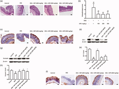 Figure 3. IOP alleviates colon tissue injury caused by DSS and restores the loss of tight junction (TJ) proteins. Colitis was induced by orally giving DSS (3%), in the first two cycles, mice were given DSS (3%) for five days and followed by water for 14 days, and the third cycle, mice were just given DSS (3%) for five days, modelling 43 days in total. (a) Histopathological changes and inflammation of colon. (b) Histopathological score. (c) ZO-1 expression in colon tissue was examined with immunohistochemical staining. (d,e) ZO-1 expression in colon tissue detected with western blot. (f) Occludin expression in colon tissue tested with immunohistochemical staining. (g,h) Occludin expression in colon tissue examined by western blot. Microphotographs were taken at ×20 magnification; bars = 50 µm. *p < .05, **p < .01 compared with model group; #p < .05, ##p < .01 compared with control group.