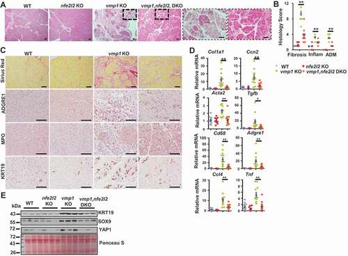 Figure 6. Deletion of nfe2l2 attenuates vmp1 deficiency-induced pancreatitis. Two-months-old Tg(Cela1-cre/ERT)/BAC-Ela-Cre−; Vmp1f/f (Vmp1 WT), Tg(Cela1-cre/ERT)/BAC-Ela-cre+; vmp1f/f (vmp1 KO), Tg(Cela1-cre/ERT)/BAC-Ela-cre−; Vmp1f/f nfe2l2 KO (nfe2l2 KO), Tg(Cela1-cre/ERT)/BAC-Ela-cre+; vmp1f/f nfe2l2 KO (vmp1, nfe2l2 DKO) mice were injected with tamoxifen (75 mg/kg) once a day for consecutive 3 days, and these mice were sacrificed 5 days after the last injection of tamoxifen. (A) Representative images of H&E staining of Vmp1 WT, nfe2l2 KO, vmp1 KO, and vmp1, nfe2l2 DKO mice are shown. Bar: 100 µm. (B) Histology score was quantified. Data shown are mean ± SE (n = 8–13). **p < 0,01; One-way ANOVA analysis. (C) Representative images of Sirius red, ADGRE1/F4/80, MPO, KRT19, SOX9, and YAP1 staining are shown. Bar: 100 µm. (D) Pancreatic mRNA was extracted followed by qPCR analysis. Results were normalized to Rpl13a and expressed as fold change compared to Vmp1 WT group. Data shown are mean ± SE (n = 10–17). **p < 0,01; One-way ANOVA analysis. (E) Immunoblotting analysis using total pancreatic lysates from indicated genotypes of mice.