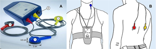 Figure 1 (A) LEOSound-recorder with three body microphones (1) and an integrated ambient microphone (2). The size of the body microphone has been displayed. (B) Illustration of how to wear the recorder during the observation. The Figure depicts the position if the tracheal microphone (blue) and the two bronchial microphones (red and yellow). The recorder was worn with one strap around the neck and one around the chest.