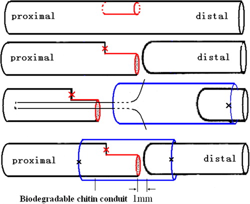 Figure 1. Illustration of surgical procedures. 1/2 Proximal tibial nerve segment was served as father nerve to repair the distal nerve stump using biodegradable chitin conduits with a gap of 1 mm.
