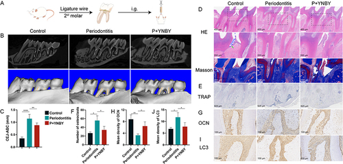 Figure 1 YNBY reduces alveolar bone loss in periodontitis rats. (A) Modelling steps of the periodontitis rat model. (B) Three-dimensional and two-dimensional micro-CT reconstruction of rat alveolar bone; dotted circle lines, interdental alveolar crestal bone; solid lines, direction of tooth root. (C) Quantitative analysis of distance from the CEJ to ABC. (D) Histological staining of alveolar bones, including H&E and Masson trichrome staining; green arrows, enamel; low-magnification scale bar, 400 μm; high-magnification scale bar, 200 μm. (E and F) TRAP staining of alveolar bones (E) and quantitative analysis of osteoclast number (F); scale bar, 625 μm. (G) Immunohistochemistry of OCN; scale bar, 100 μm. (H) Quantitative analysis of the immunohistochemistry in G. (I) Immunohistochemistry of LC3; scale bar, 100 μm. (J) Quantitative analysis of the immunohistochemistry in I. Data are expressed as the mean ± SD; *p < 0.05; **p < 0.01; ****p < 0.0001.