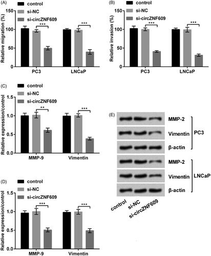 Figure 4. Silencing circular RNA circZNF609 (circZNF609) restrained cell migration and invasion. (A) Silencing circZNF609 restrained cell migration in PC3 and LNCaP cells. (B) Silencing circZNF609 restrained cell invasion in PC3 and LNCaP cells. (C–E) Silencing circZNF609 restrained the levels of matrix metalloproteinase-9 (MMP-9) and Vimentin in PC3 and LNCaP cells. (**p < .01; ***p < .001).