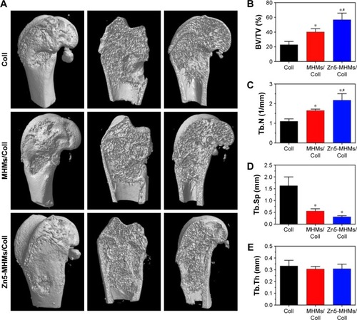 Figure 7 Micro-CT analysis of bone regeneration for the Coll, MHMs/Coll, and Zn5-MHMs/Coll groups at 8 weeks postimplantation. (A) 3D reconstructed superficial and interior images of femoral condyle defects implanted with different scaffolds. Morphometric analysis of the BV/TV (B), Tb.N (C), Tb.Sp (D), and Tb.Th (E) for each group. *P<0.05 compared to Coll group; #P<0.05 compared to MHMs/Coll group.Abbreviations: micro-CT, micro-computed tomography; MHMs/Coll, mesoporous hydroxyapatite microspheres/collagen scaffold; 3D, three dimensional; BV/TV, bone volume to total volume ratio; Tb.N, trabecular number; Tb.Sp, trabecular spacing; Tb.Th, trabecular thickness.