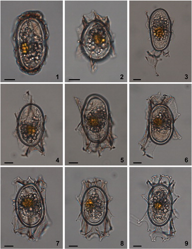 Plate 1. Bright-field photomicrographs of the Spiniferites elongatus sensu lato cysts isolated from the Beaufort Sea that were used in the genetic analyses. The National Center for Biotechnology Information (NCBI) GenBank accession numbers associated to the specimens are KU358942 (cyst 1), KU358943 (cyst 2), KU358944 (cyst 3), KU358945 (cyst 4), KU358946 (cyst 5), KU358947 (cyst 6), KU358948 (cyst 7), KU358949 (cyst 8), and KU358950 (cyst 9). Scale bars = 10 μm.