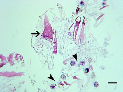 Figure 18. Exoskeleton of a recently molted white shrimp (Litopenaeus setiferus) with black gill, showing the presence of Hyalophysa lynni (arrowheads) and nodules (arrows). H & E. Scale bar: approx. 50 µm. Used with permission from Frischer et al. (Citation2018).