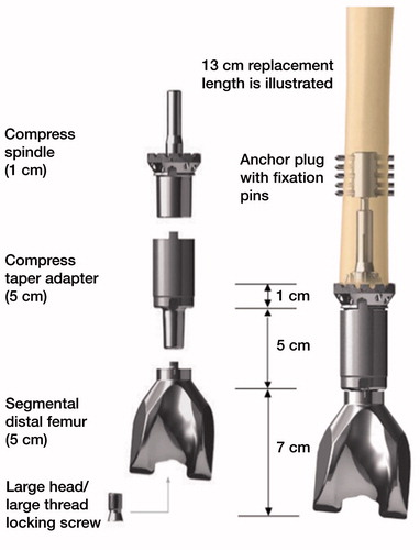 Figure 1. Compress components with distal femoral adaptor.