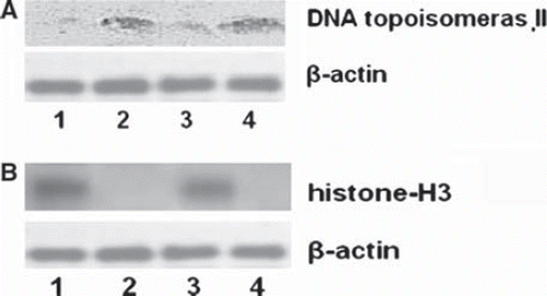 Figure 1. Western blot analysis of DNA topoisomerase II (A) and histone (B). Lane 1, nuclear protein of normal breast. Lane 2, nuclear matrix protein of normal breast. Lane 3, nuclear protein of breast carcinoma. Lane 4, nuclear matrix protein of breast carcinoma. β-actin as used as an internal loading control.