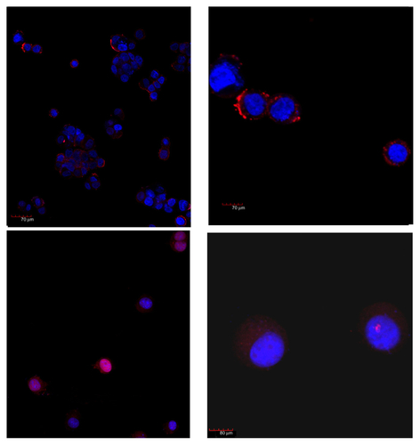 Figure S9. Laser scanning confocal microscopy of human HT29 colon carcinoma cells after 10 (top) and 60 (down) minutes of incubation with HFt rhodamine-labeling. Clusters of HFt-based nanoparticles with rhodamine fluorescence appear in red.Note: Original magnification 40× (left) and zoom 3× (120×, right) were used.Abbreviation: HFt, human protein ferritin.