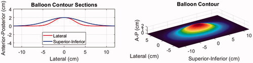 Figure 4. Illustration of the water balloon displacement profile applied to the patient models.