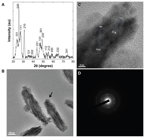 Figure 3 YF3 NP crystallinity characterization. (A) Powder XRD analysis of the crystalline NPs. The XRD pattern matched the reflection peaks and relative Miller indices of orthorhombic YF3. (B) HR-TEM micrographs of YF3 NPs and (C) characteristic lattice fringes of the crystalline phases indicated by the black arrow in (B). (D) Selected area diffraction patterns of polycrystalline YF3 NPs shown in (B).Abbreviations: HR-TEM, high-resolution transmission microscope; NP, nanoparticle; XRD, X-ray diffraction; YF3, yttrium fluoride.