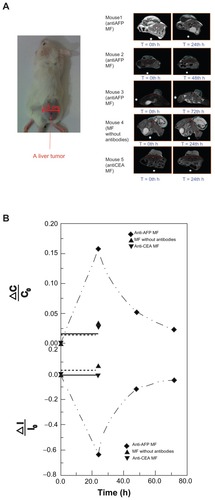 Figure 3 MRI examination of a liver tumor. (A) Photos of the test mice and representative MRI images of the liver tumor at different examination time. (B) The variation ratio of the average normalized intensity ΔI/I0 and the variation of image contrast ΔC/C0.Abbreviations: AFP, alphafetaprotein; CEA, carcinoembryonic-antigen; MF, magnetic fluid; MRI, magnetic resonance imaging.