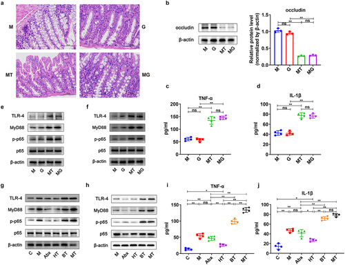 Figure 5. Effects of GANT61 on intestinal barrier damage and NF-κB signaling of EOC model. a H&E staining images of intestine tissues were displayed after treatments of mice in M, G, MT and MG groups. b Western blot analysis of occludin expression in intestine tissues (n = 3/group). The relative expression of proteins occludin were quantified by Image J. c-d Concentrations of TNF-α and IL − 1β in serum from each group described in Fig. 4a at day 90. e Western blot analysis in the expression of TLR − 4, MyD88, p-p65 and p65 in intestine tissues (n = 3). f Western blot analysis in the expression of TLR − 4, MyD88, p-p65 and p65 in tumor tissues (n = 3/group). g-h Western blot analysis of TLR − 4, MyD88, p-p65 and p65 expression in intestine and tumor tissues from each group described in Fig. 2a (n = 3/group). i-j Serum concentrations of TNF-α and IL − 1β from each group described in Fig. 2a at day 90. Data are presented as means ± SD. One-way ANOVA with Tukey’s test for multiple comparisons; ANOVA, analysis of variance. *P < 0.05, **P < 0.01.