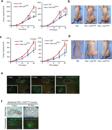 Figure 2. Evaluation of the contribution of activated fibroblasts to tumor growth. TE cells alone or co-cultured with either CAFTGFβ (fibroblasts activated with TGFβ) or CAFTEco (fibroblasts co-cultured with TE cells) were inoculated subcutaneously into mice. The mean tumor volume (±SEM) was calculated for each group. (a and b) TE4+CAFs tumors (n = 4) showed significant progressive growth compared with TE4 tumors alone (CAFTGFβ P= .0002; and CAFTE4co P= .0101; two-tailed Student’s t-test at 28 d); scale bar in images, 10 mm. (c and d) The same experiments were performed using TE8 cells, with the pattern of engraftment following the same trend as for TE4 (CAFTGFβ vs. TE8 alone, P= .050, n = 3; CAFTE8co vs. TE8 alone, P= .078, n = 4; two-tailed Student’s t-test at 28 d); scale bar in photographs, 10 mm. (e) Representative images of fluorescence microscopy show the presence of GFP-positive fibroblasts in tumor-bearing mice. The large pictures show the whole mouse body, with the dotted lines indicating the tumor. The small panels show sections of the tumors in greater detail. Scale bars, 10 mm (macro), 5 mm (section). Green arrowheads indicate the presence of GFP-positive fibroblasts. (f) Fluorescence microscopy detects the presence of GFP-positive fibroblasts (green arrowheads) on 7 and 21 d after initial inoculation of mice, in sectioned tumors. Scale bars, 5 mm (section).