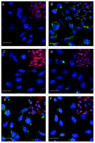 Figure 3. Comparison of PTx and different PTds inactivated with different approaches in translocation to CHO cells shown by the fluorescence intensity of target protein in confocal images. CHO cells were treated with PTx or PTd for 12 h simultaneously. (A) Negative control; (B) Positive control, PTx (200 ng/ml); (C) PTd-I (200 ng/ml); (D) PTd-II (200 μg/ml); (E) PTd-III (200 μg/ml); (F) PTd-IV (200 μg/ml). Green fluorescence is of target protein, blue fluorescence is of nucleus, and red fluorescence representing F-actin of cytoskeleton. For clarity, each plate is presented showing only blue/ green fluorescent channels with an insert showing red/ blue/ green fluorescence. Scale bar = 20 μm.