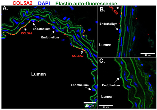 Figure 6 Collagen type V alpha 2 was detectable in mouse vessels on the apical surface of endothelial cells. CLSM detection of COL5A2 (red) on the apical surface of the endothelium in histological sections of mouse uniform flow conditioned vessels, (A) descending aorta and (B) right carotid. (C) Minor COL5A2 (red) signal was observed in the acute disturbed flow conditioned LCA. Nuclei shown in blue. Auto-fluorescence from elastin (green) was imaged to identify vessel wall. Scale Bars = 20 μm.