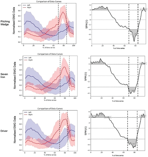 Figure 2. Comparison of the data curves as a percentage of time (left) and SPM analysis (right) for enveloped EMG for the lead and trail side during the whole of the golf swing. “Swing Onset” occurs at 0, the first vertical dotted line indicates the “Top of Swing” event, the second vertical dotted line indicates the “Impact” event and “Swing End” occurs at 100.