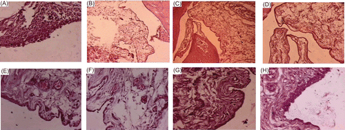 Figure 7.  Histopathological observation of inflamed tissues. (a and b) arthritic control; (c and d) normal architecture of synovial membrane, (e and f) TA-loaded chitosan microsphere treated group on 30th day, (g and h) TA-loaded chitosan microsphere treated group on 60th day.