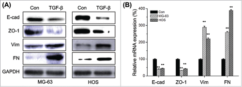 Figure 2. TGF-β triggers the EMT of osteosarcoma cells. (A) MG-63 and HOS cells were treated with or without TGF-β (20 ng/ml) for 48 h, then the protein levels of E-cad, ZO-1, Vim, and FN were analyzed by Western blot analysis; (B) MG-63 and HOS cells were treated with or without TGF-β (20 ng/ml) for 24 h, then the mRNA levels of E-cad, ZO-1, Vim, and FN were analyzed by qRT-PCR. Data are presented as means ± SD of 3 independent experiments. **p < 0.01 compared with control.
