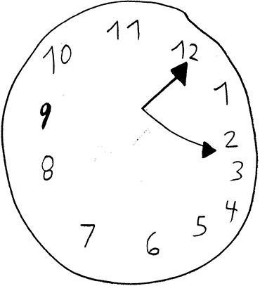 Figure 2 ASD-J DAC with qualitative errors: Size: Acceptable; Graphomotor: slightly wobbly circle, 9 darkened as are the hands (a repetitive behavior). Numbers well-formed, legible; Spatial planning: numbers crowded to right; hands off-center; uneven spaces at lower and left quadrant; Conceptualization: all numbers present in correct sequence but incorrectly placed: 11–6 and 9–1 opposed instead of 12–6 and 9–3; Note: while darkening the hands (the hour hand is 4 mms long, the minute hand is 6 mms), he was asked the time he wanted to show, he said, 2:00 o’clock but here 12:10 is set– shows weak knowledge of clock time setting, and features.