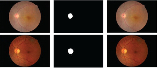 Figure 4. OD centre obtained by method 1 for images from private dataset.