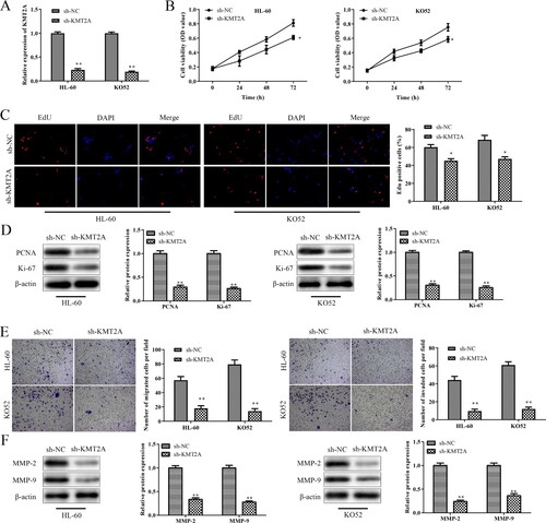 Figure 2. Down-regulation of KMT2A prevents AML cells from proliferating, migrating, and invading. Expression of KMT2A in HL-60 cells and KO52 cells which were transfected with sh-NC or sh-KMT2A was assessed using a qRT-PCR assay (A). (B) The CCK-8 assay was used to explore the vital capability of HL-60 cells and KO52 cells that had been transfected with sh-NC or sh-KMT2A at the specified times. (C) The EdU assay was used to detect the proliferating ability of HL-60 cells and KO52 cells that had been transfected with sh-NC or sh-KMT2A. (D) Western blot assay was used to assess PCNA as well as Ki-67 protein expressions in HL-60 cells and KO52 cells which were transfected with sh-NC or sh-KMT2A. (E) Transwell migration and invasion assays were adopted to evaluate the migration and invasion of HL-60 cells and KO52 cells which were transfected with sh-NC or sh-KMT2A. (F) Western blot assay was adopted to assess the protein expressions of MMP-2 as well as MMP-9 in HL-60 cells and KO52 cells which were transfected with sh-NC or sh-KMT2A. *P < 0.05, **P < 0.01 vs. sh-NC group. All data were exhibited as mean ± SD. n = 3.