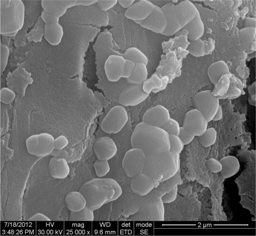 Figure 3 Scanning electron microscopic image of green silver nanoparticles synthesized by reduction of aqueous AgNO3 ions using aqueous extract of Gymnema sylvestre.Abbreviations: HV, high voltage; WD, working distance; mag, magnification; ETD, Everhart–Thornley detector.