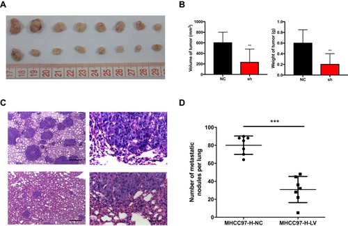 Figure 4 HCC cell growth and metastasis in vivo suppressed by CCDC34-KD.Notes: (A) The MHCC97-H cells transfected with shCCDC34 or NC lentivirus were subcutaneously injected into the nude mice (n=8). The top tumors were produced by MHCC97-H-NC cells, while the bottom by MHCC97-H-shCCDC34 cells. (B) The volume and weight of tumors harvested from the nude mice were measured. (C) Representative H&E staining in lung sections obtained from the nude mice injected with the MHCC97-H-shCCDC34 or NC cells through the tail veins (n=7). Scale bar = 500 μm (left) and 50 μm (right). The top tumors were produced by MHCC97-H-NC cells, while the bottom by MHCC97-H-shCCDC34 cells. (D) The number of metastatic tumors per lung was counted. **P<0.01; ***P<0.001.Abbreviations: KD, knockdown; HCC, hepatocellular carcinoma; NC, negative control.