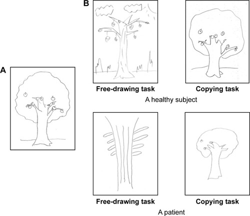 Figure 2 Examples of tree-drawings.