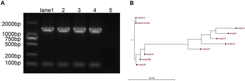 Figure 2 (A) Gel map of amplification products. Lanes 1, 2, 3, and 4 are PCR products with nucleic acid template amounts of 0.25µL, 0.5µL, 1µL, and 1.5µL, respectively, and lane 5 is a negative control. (B) Alignment of ompA gene from patient 1 with all ompA types.