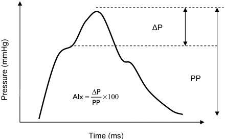 Figure 1 Representation of central arterial waveform.