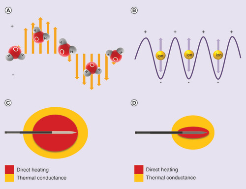 Figure 1. Underlying mechanism of action and heat transfer for microwave ablation and radiofrequency ablation.microwave ablation A & C; radiofrequency ablation B & D.