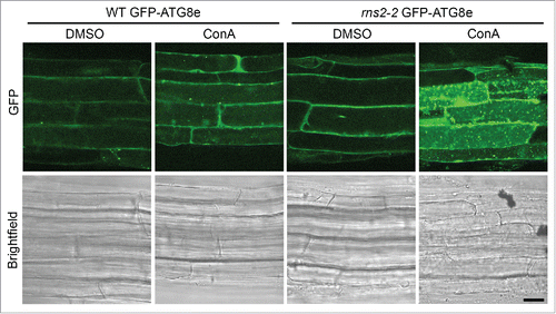 Figure 1. GFP-ATG8e-containing autophagic bodies accumulate in rns2–2 seedling root cells. Seven-d-old transgenic Arabidopsis WT and rns2–2 seedlings expressing the GFP-ATG8e autophagosome marker were treated for 5 h with either DMSO as a solvent control or 1 μM ConA to block vacuolar degradation. Roots were visualized by confocal microscopy. Images are representative of 3 biological replicates. Scale bar: 10 μm.