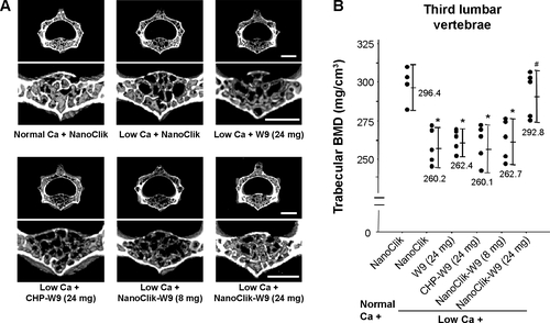 Figure S2 Radiological assessments of the third lumbar vertebrae.Notes: (A) Three-dimensional reconstruction images (upper panel) and trabecular-rich region (lower panel) of the third lumbar vertebrae were examined by microfocal computed tomography. The bar represents 1 mm. (B) Results of a quantitative analysis of trabecular BMD at the vertebral body measured by peripheral quantitative computed tomography. The data are shown as the mean ± standard deviation with n=5 for each experimental group. *P<0.05 versus normal Ca + NanoClik; #P<0.05 versus low Ca + NanoClik.Abbreviations: BMD, bone mineral density; Ca, calcium; CHP, cholesterol-bearing pullulan; Normal Ca + NanoClik (n=5), vehicle (NanoClik nanoparticle)-injected mice fed a normal calcium diet; low Ca + NanoClik (n=5), vehicle (NanoClik nanoparticle)-injected mice fed a low calcium diet; low Ca + W9 (24 mg, n=5), W9 (24 mg/kg/day) was injected into mice fed a low calcium diet; low Ca + CHP-W9 (24 mg, n=5), W9 (24 mg/kg/day) incorporated in CHP nanogels was injected into mice fed a low calcium diet; low Ca + NanoClik-W9 (8 mg, n=5), W9 (8 mg/kg/day) incorporated in NanoClik nanoparticles was injected into mice fed a low calcium diet; low Ca + NanoClik-W9 (24 mg, n=5), W9 (24 mg/kg/day) incorporated in NanoClik nanoparticles was injected into mice fed a low calcium diet.