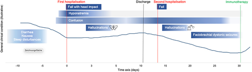 Figure 3 Illustration of the patient`s clinical course until established diagnosis of anti-LGI1-encephalitis.