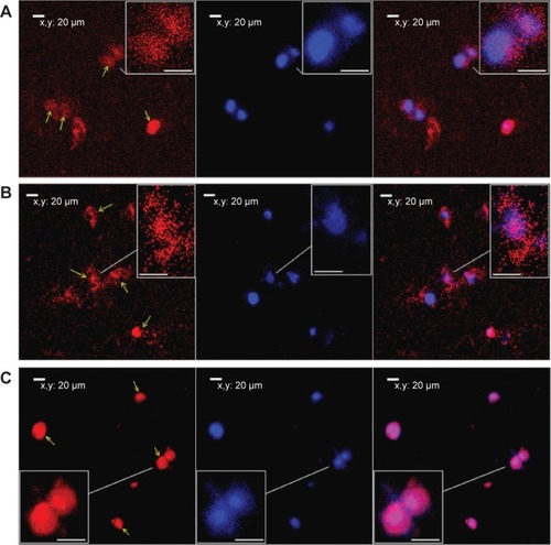 Figure 9 Fluorescence tracking of PG6-PEI-INO polymers in 293T cell nuclei.Notes: Fluorescence was analyzed after the 293T cells were cocultivated for 48 hours with (A) PG6-PEI-INO-Rh 1, (B) PG6-PEI-INO-Rh 2, and (C) PG6-PEI-INO-Rh 3, which had increased inositol ligands per molecule (1:1, 1:10, and 1:35, respectively). Accumulation of PG6-PEI-INO-Rhs in cell nuclei was indicated with arrows. Scale bar in magnified images: 15 μm. Red fluorescence shows Rhodamine B (Emission: ~572 nm) labeled polymers. Blue fluorescence shows the cell nuclei stained with DAPI (Emission: ~461 nm when bound with DNA). Merged images in purple color show the PG6-PEI-INO-Rh polymers in cell nuclei.Abbreviations: DAPI, (4′,6-diamidino-2-phenylindole); INO, myo-inositol; PEI, polyethylenimine; PG6, polyglycerol; Rh, Rhodamine.