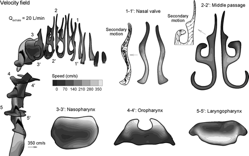 FIG. 3 Velocity fields in the nasal-laryngeal airway at an exhalation flow rate of 20 L/min in three-dimensional and cross-sectional (coronal) views. The secondary motions within the nasal valves and middle turbinate region are also presented.