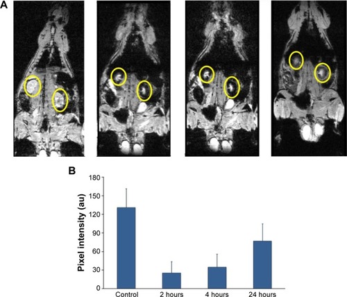 Figure 2 Renal clearance after cat-USPIOs IV administration in male Wistar rat.Notes: (A) Typical series of MRI images of a Wistar rat after IV administration of 50 mg/kg of cat-USPIOs, highlighting the variation in the density of white pixels in the kidneys, indicated by yellow circles. The leftmost image was taken before injection of cat-USPIOs (control), and then after 2, 4, and 24 hours after injection. The head of the rat is pointing up. (B) The average of normalized density of white pixels of four subsequent scans of kidneys as a function of time after IV administration of 50 mg/kg of cat-USPIOs. The concentration is inversely proportional to the density of white pixels in magnetic resonance signals.Abbreviations: cat-USPIOs, cationic ultrasmall superparamagnetic iron oxide nanoparticles; MRI, magnetic resonance imaging; IV, intravenous.