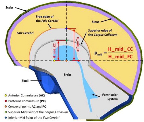 Figure 1. Model sagittal section; main anatomical landmarks and parameters for this study.