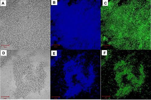 Figure 4 Fluorescence microscopy images for S. aureus biofilms stained by (A-C) 250 μg/mL and (D-F) 500 μg/mL QCS-EDA-CDs for 2.5 h.
